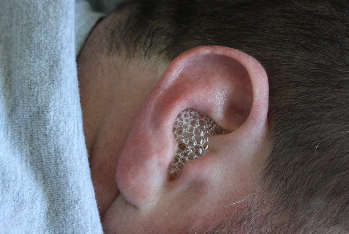 peroxide on dogs ears