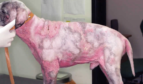 treatment for calcinosis cutis