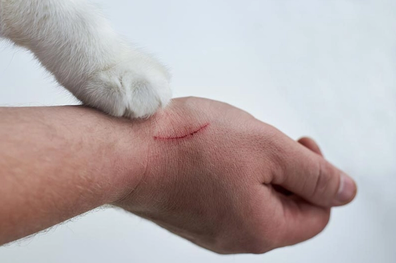 cat scratch first aid cat scratch first aid