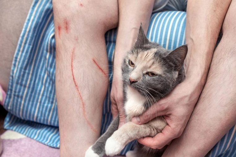 how to treat a cat scratch