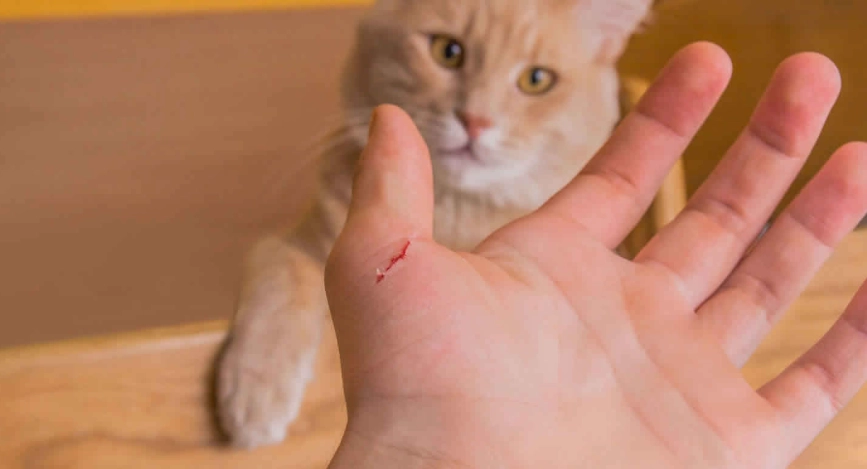 cat scratch fever treatment cat scratch fever treatment