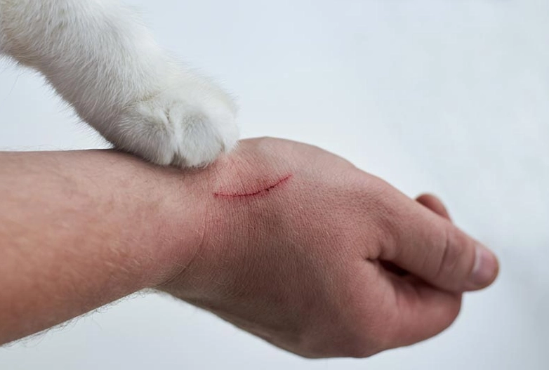 bartonella henselae infection bartonella henselae infection